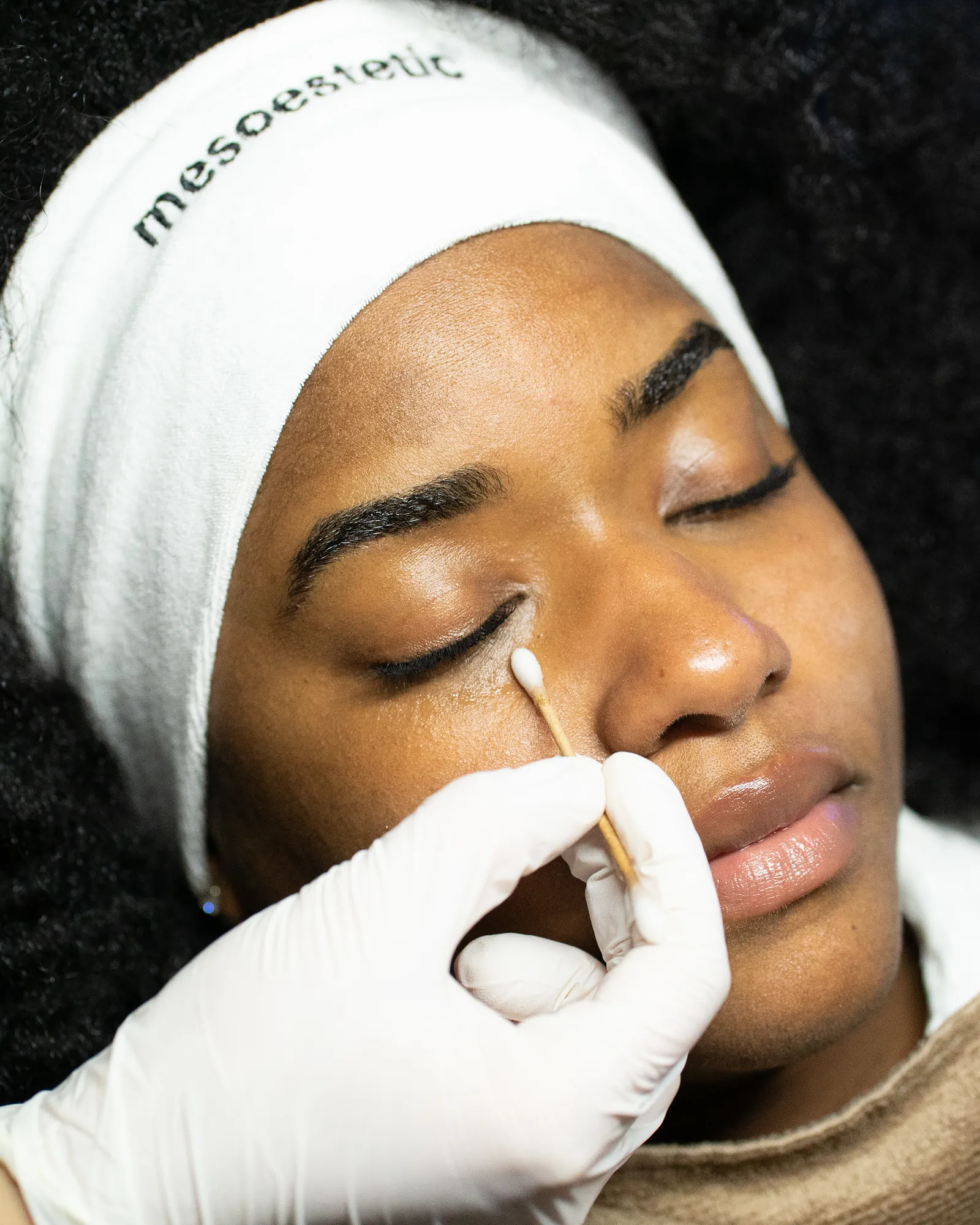 CryoLip